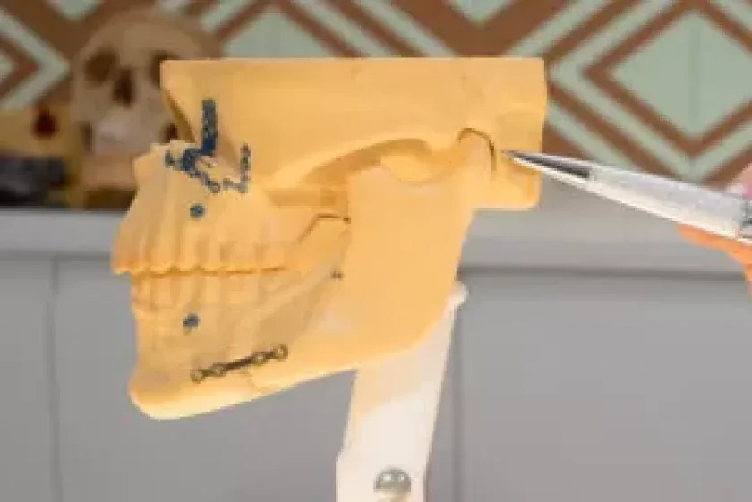 Modelo de crânio demonstrando cirurgia ortognática